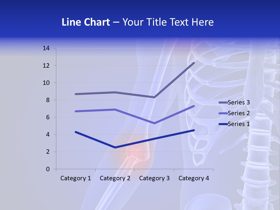 Carcass Health Elbow PowerPoint Template