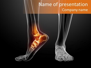 Illustration Graphic Arthritis PowerPoint Template