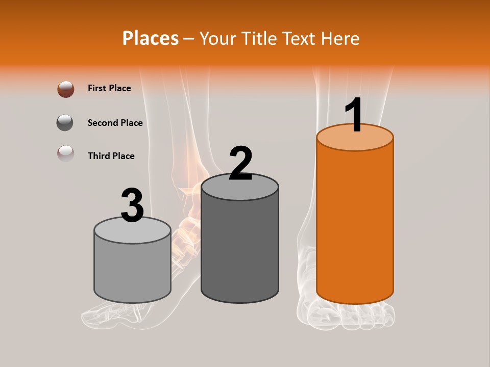 Illustration Graphic Arthritis PowerPoint Template