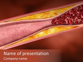 Sick Vascular Disease PowerPoint Template