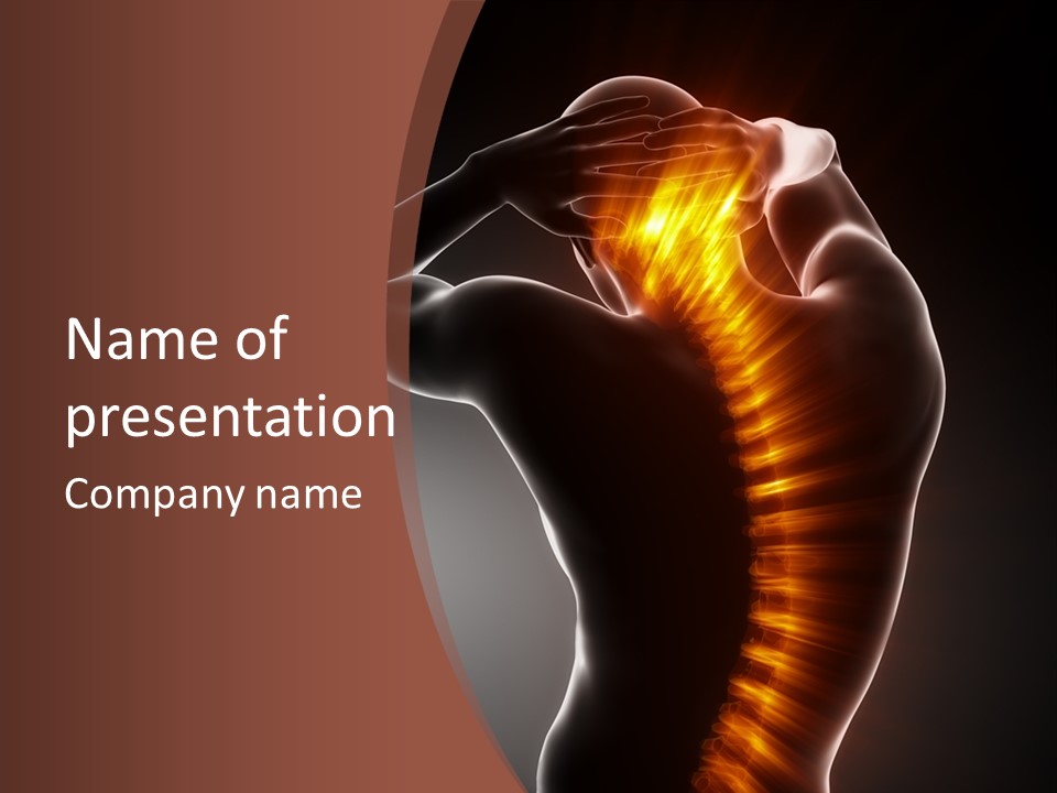 Medicine Xray Rheumatism PowerPoint Template