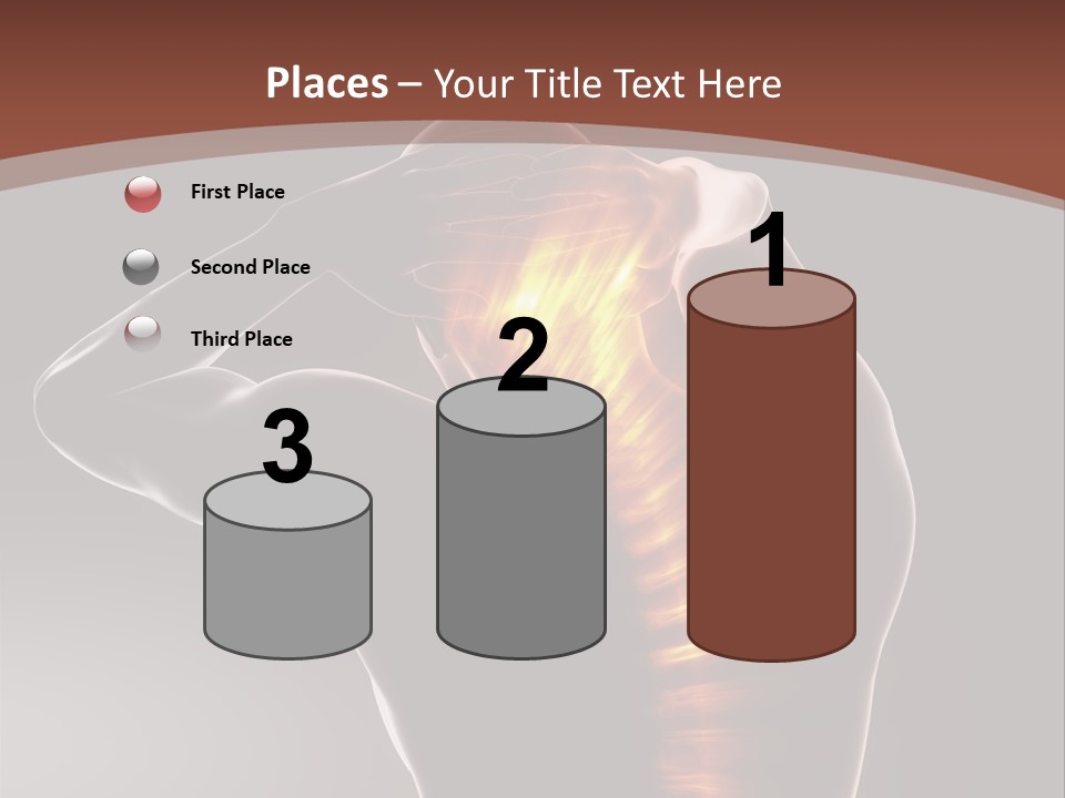 Medicine Xray Rheumatism PowerPoint Template