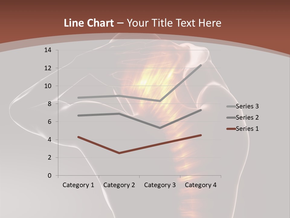 Medicine Xray Rheumatism PowerPoint Template
