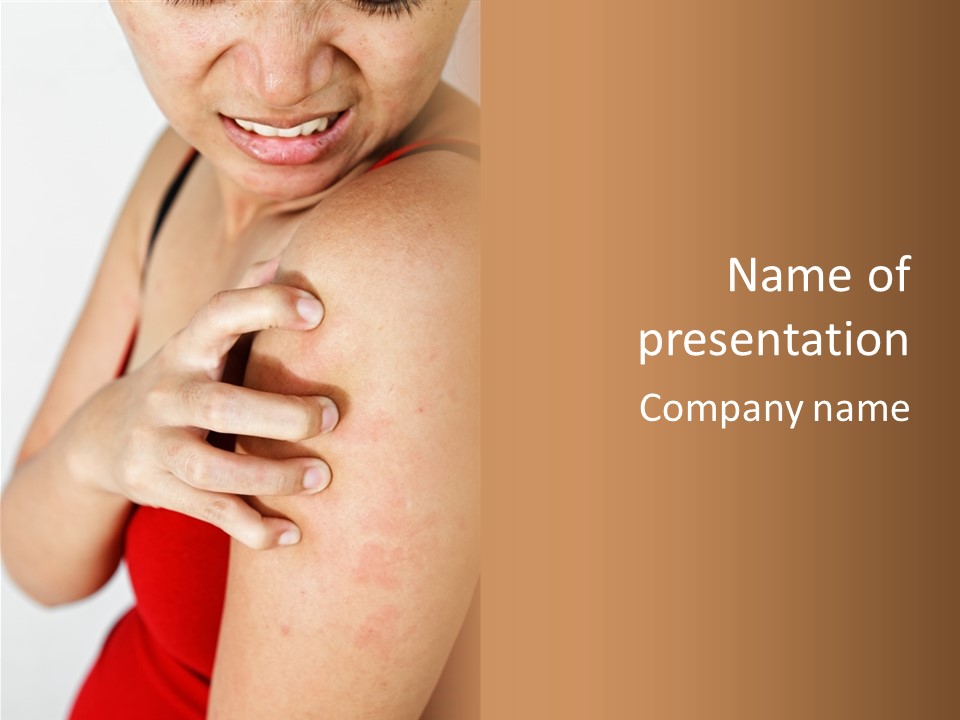 Dermatology Itch Allergic PowerPoint Template