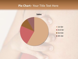 Dermatology Itch Allergic PowerPoint Template