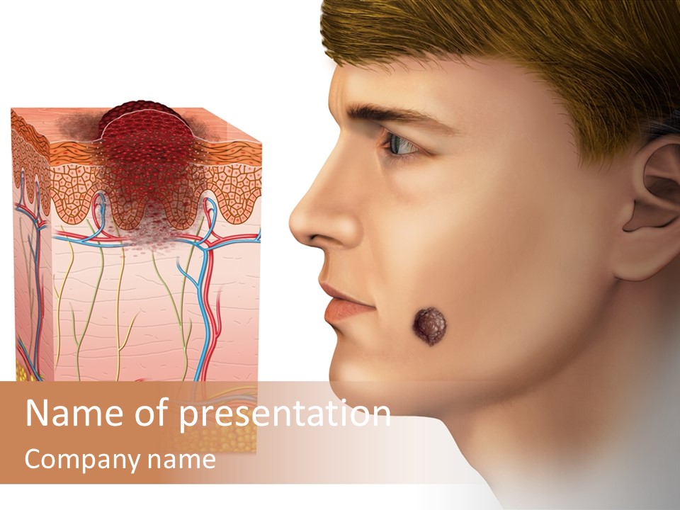 Skin Woman Degeneration PowerPoint Template