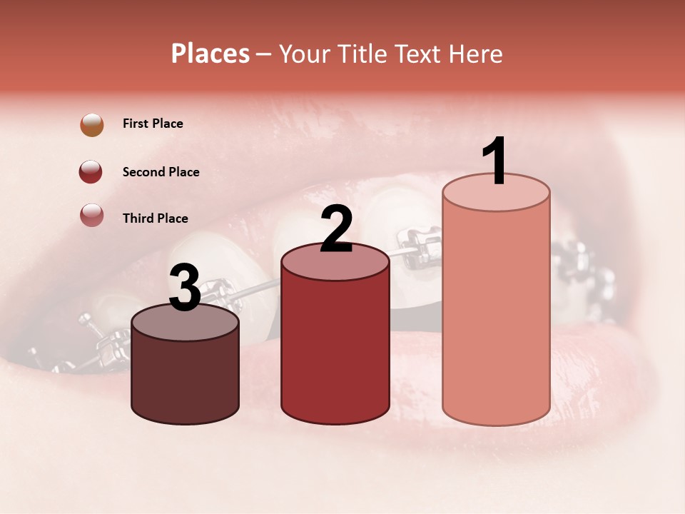 Healthy Lips Braces PowerPoint Template