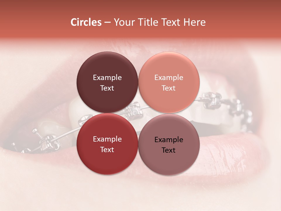 Healthy Lips Braces PowerPoint Template