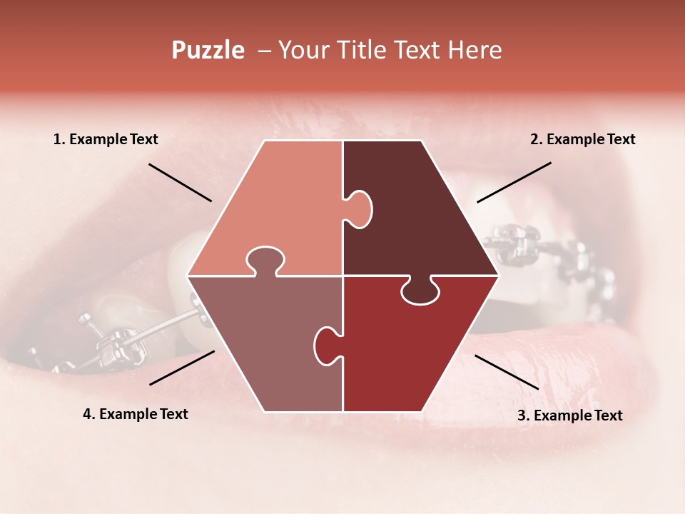 Healthy Lips Braces PowerPoint Template
