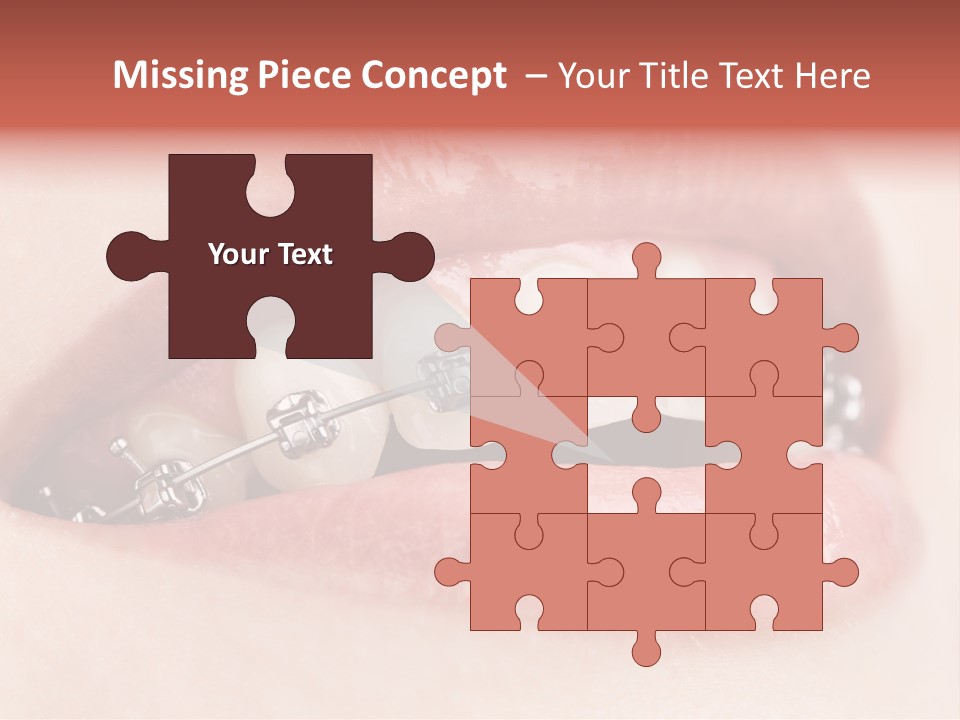 Healthy Lips Braces PowerPoint Template