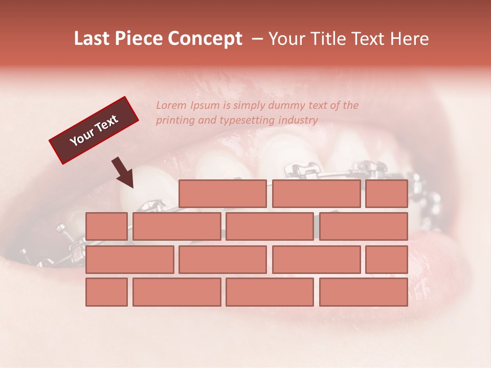 Healthy Lips Braces PowerPoint Template