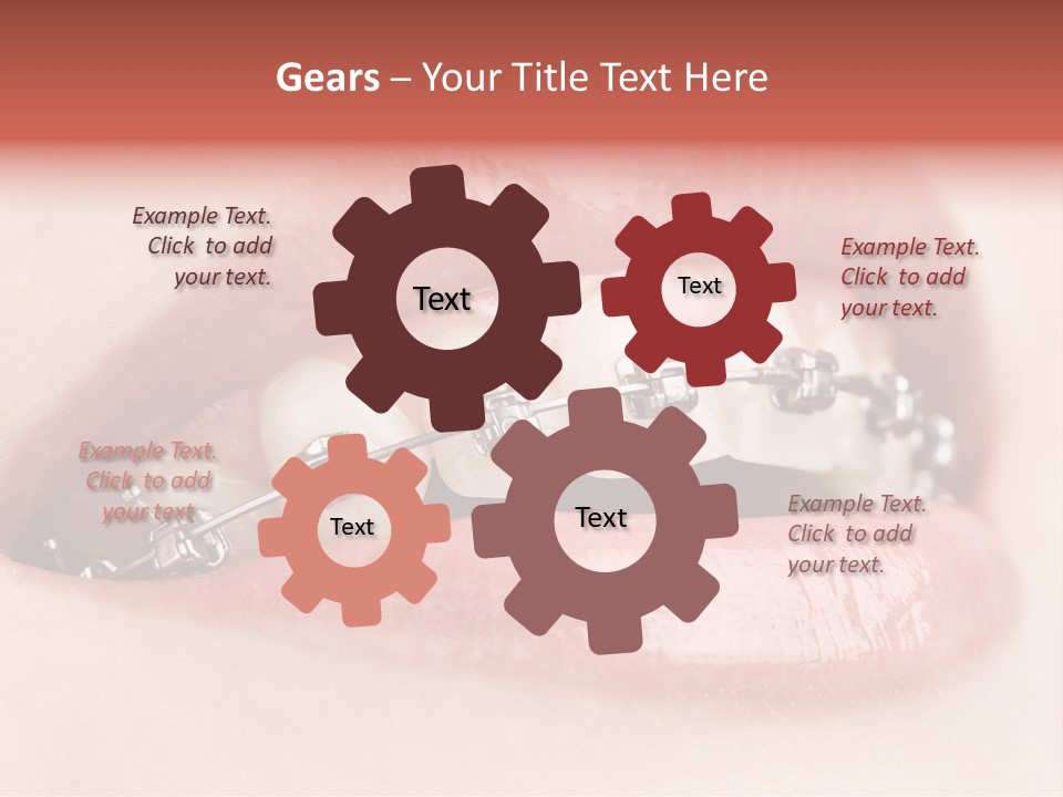 Healthy Lips Braces PowerPoint Template