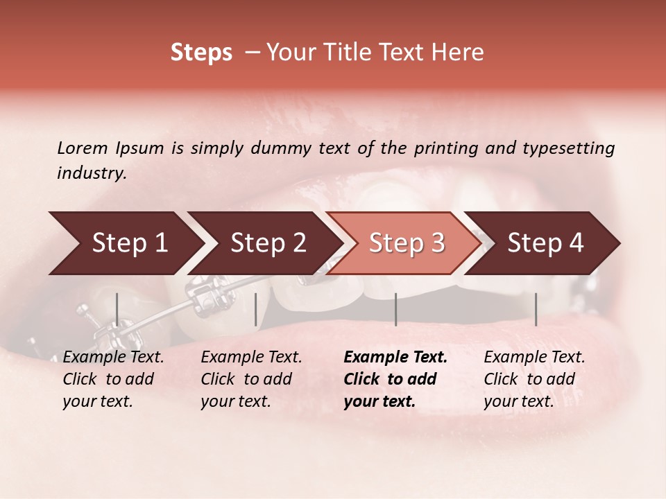 Healthy Lips Braces PowerPoint Template