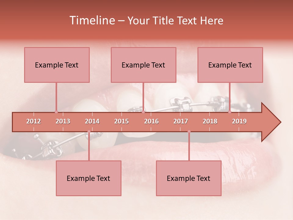 Healthy Lips Braces PowerPoint Template