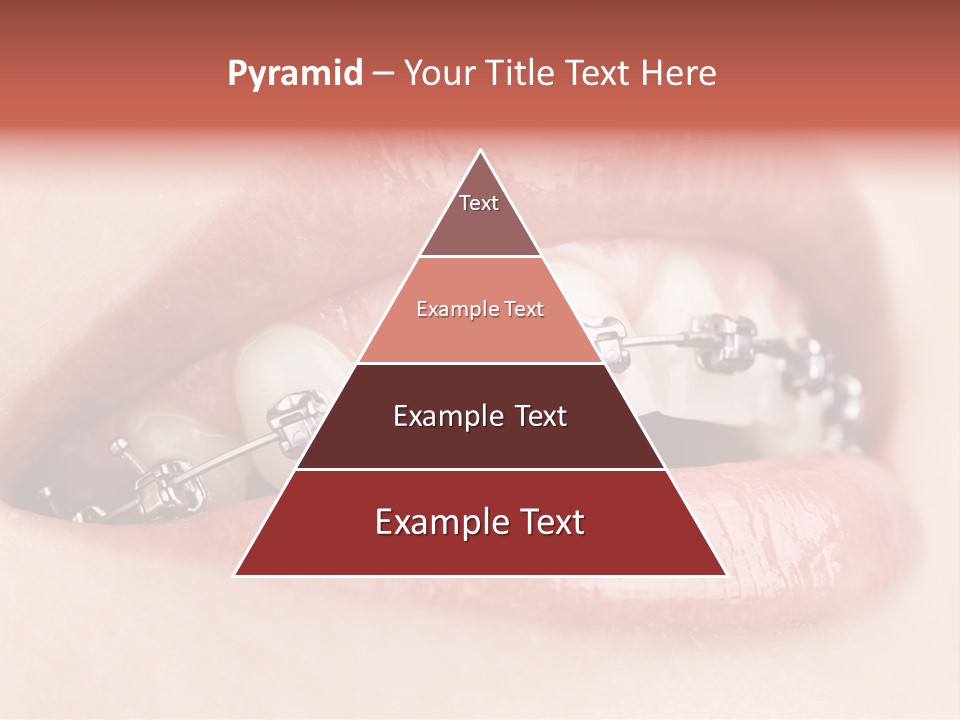 Healthy Lips Braces PowerPoint Template