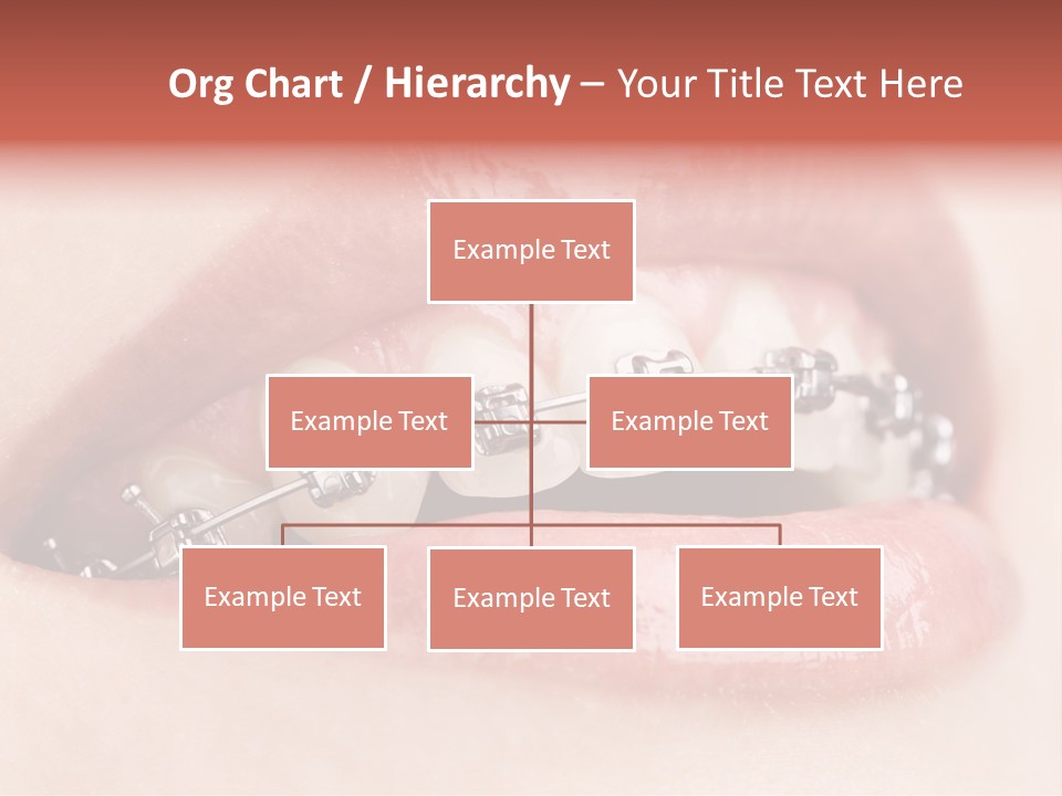 Healthy Lips Braces PowerPoint Template