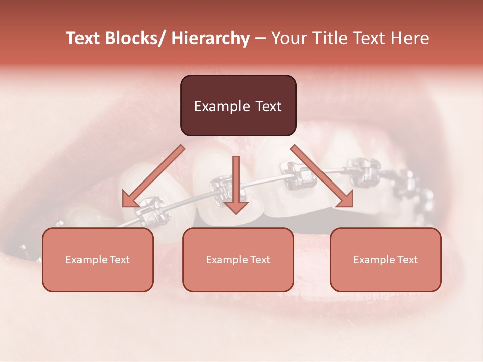 Healthy Lips Braces PowerPoint Template