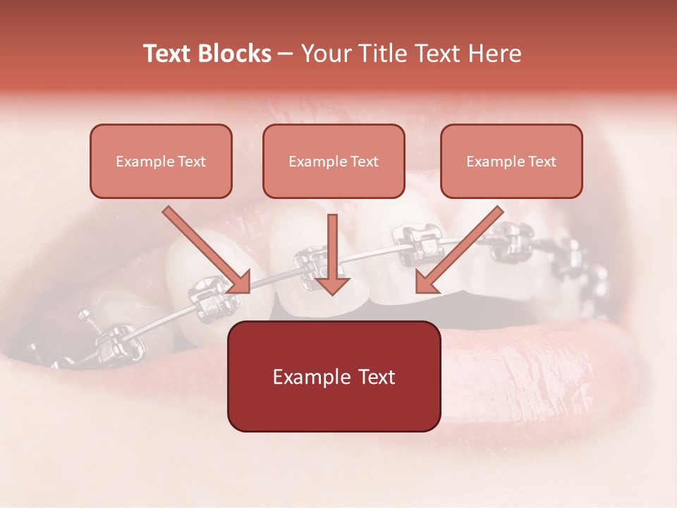 Healthy Lips Braces PowerPoint Template
