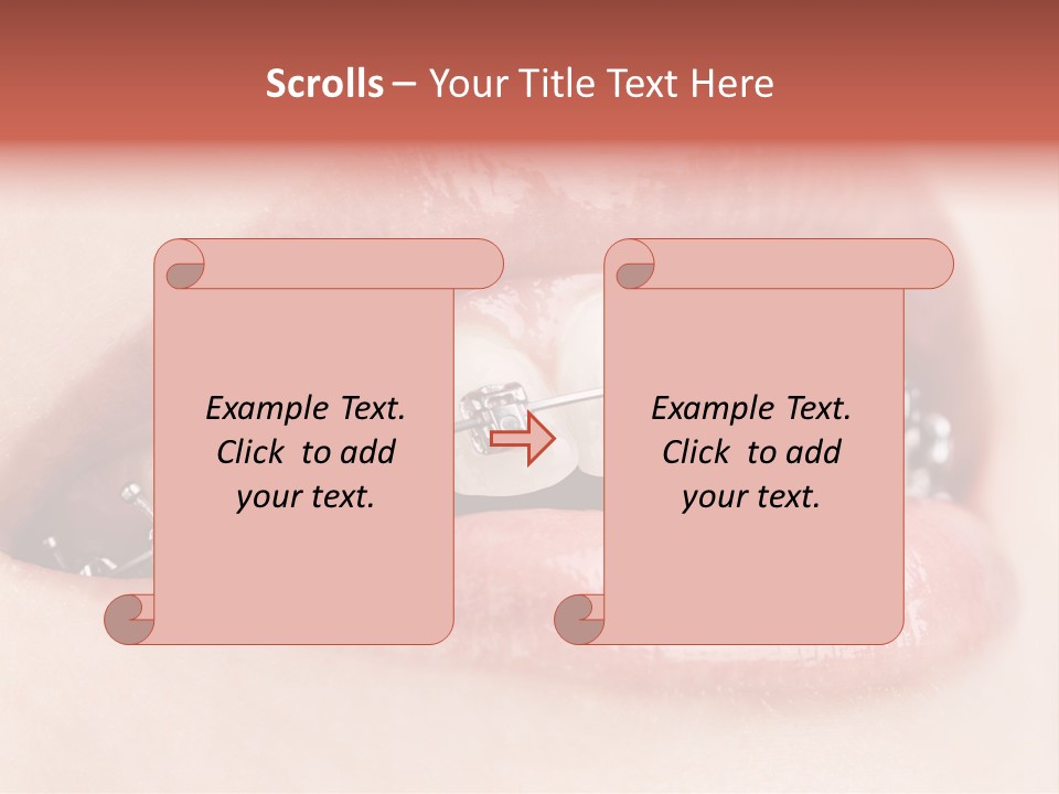 Healthy Lips Braces PowerPoint Template