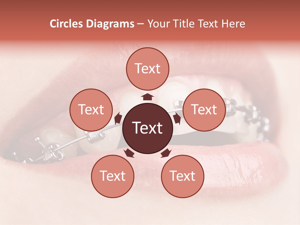 Healthy Lips Braces PowerPoint Template
