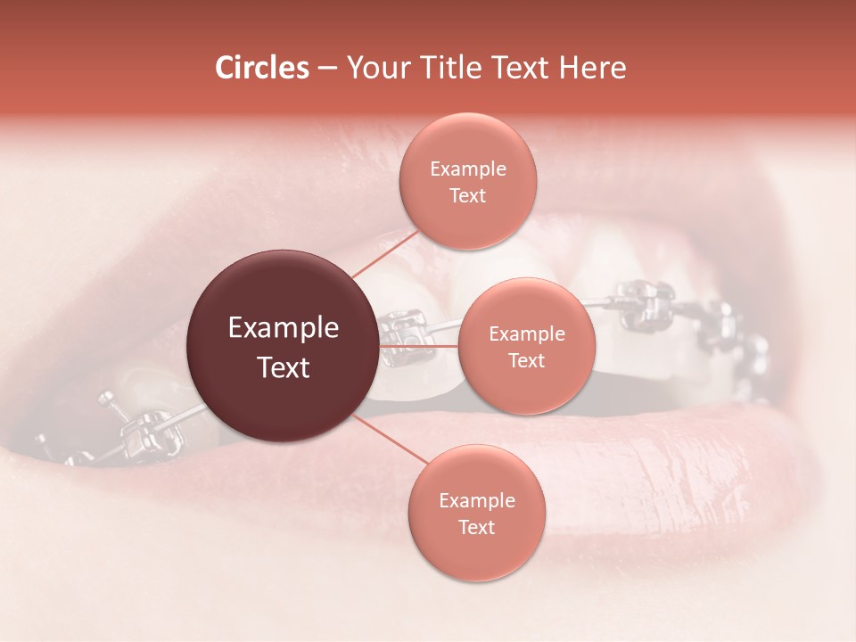 Healthy Lips Braces PowerPoint Template
