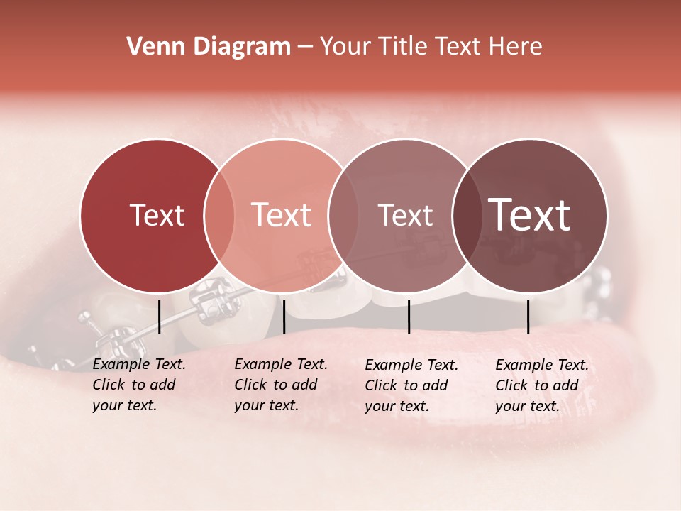 Healthy Lips Braces PowerPoint Template