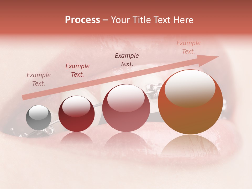 Healthy Lips Braces PowerPoint Template