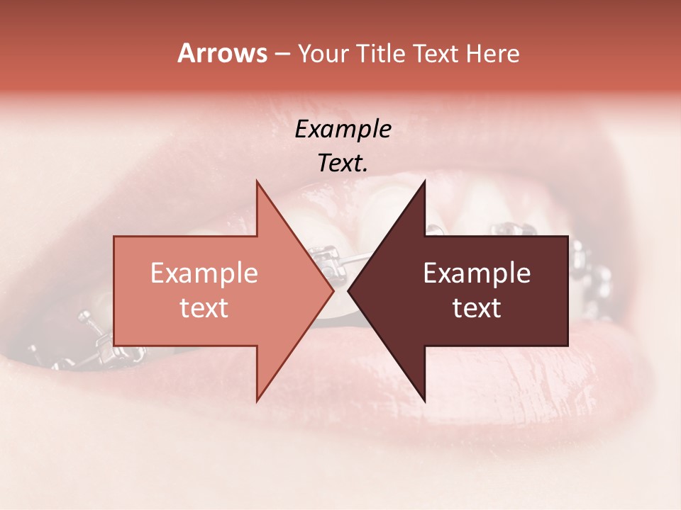 Healthy Lips Braces PowerPoint Template