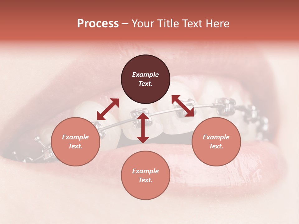 Healthy Lips Braces PowerPoint Template
