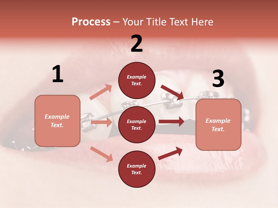 Healthy Lips Braces PowerPoint Template