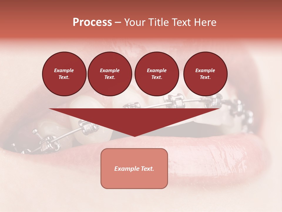 Healthy Lips Braces PowerPoint Template