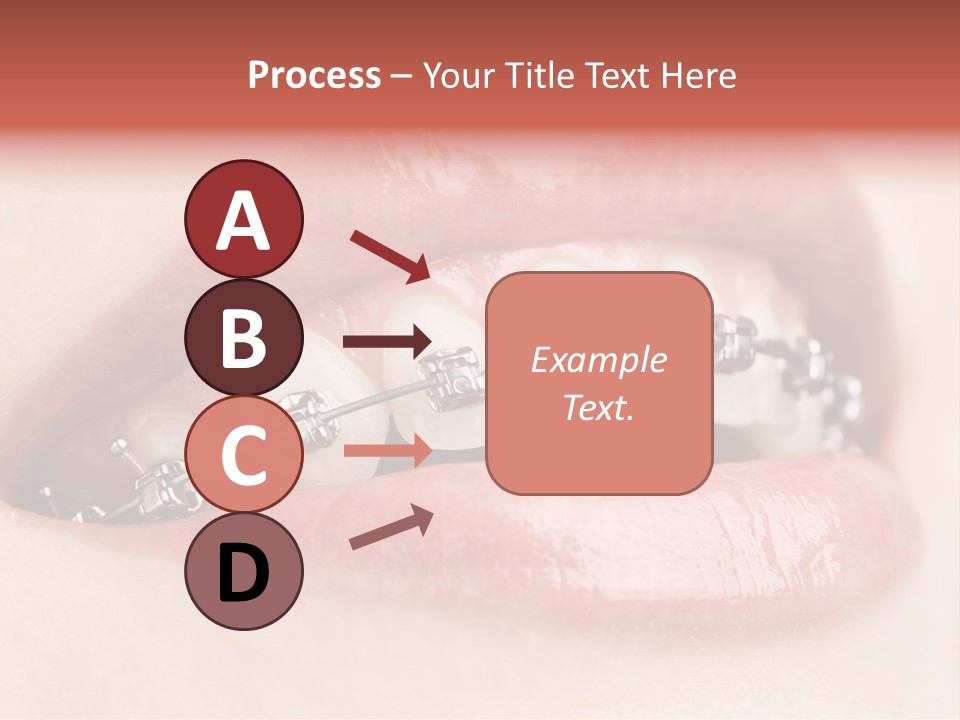 Healthy Lips Braces PowerPoint Template