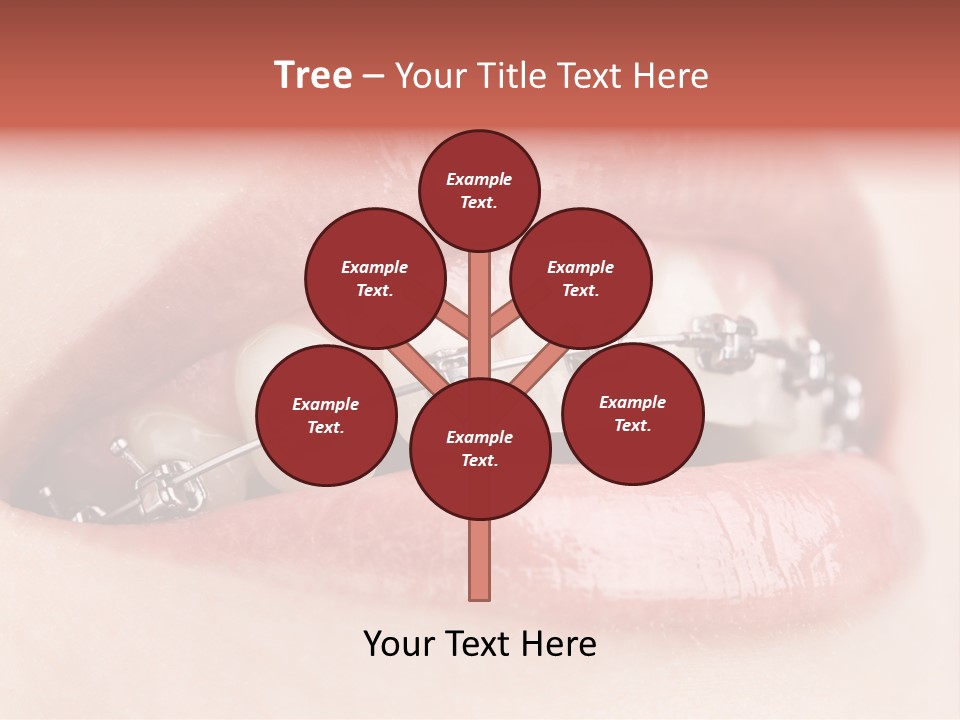 Healthy Lips Braces PowerPoint Template