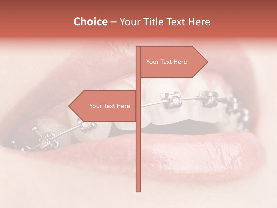Healthy Lips Braces PowerPoint Template