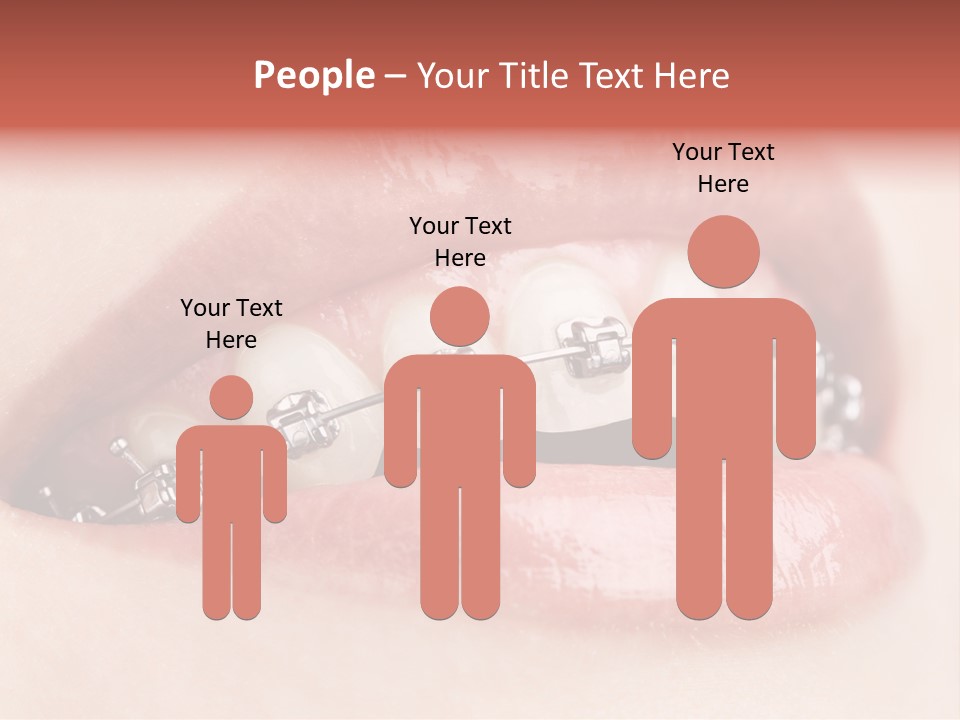 Healthy Lips Braces PowerPoint Template