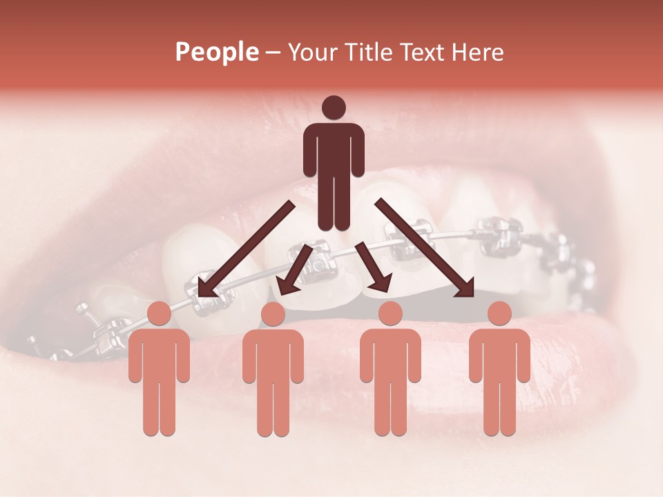Healthy Lips Braces PowerPoint Template