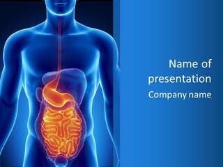 Ileocecal Valve Diagnose Abdominal PowerPoint Template