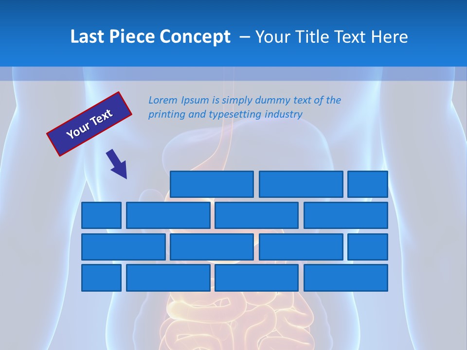 Ileocecal Valve Diagnose Abdominal PowerPoint Template