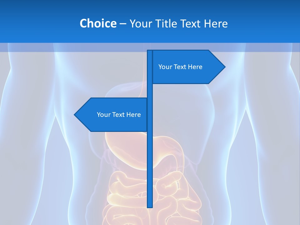 Ileocecal Valve Diagnose Abdominal PowerPoint Template