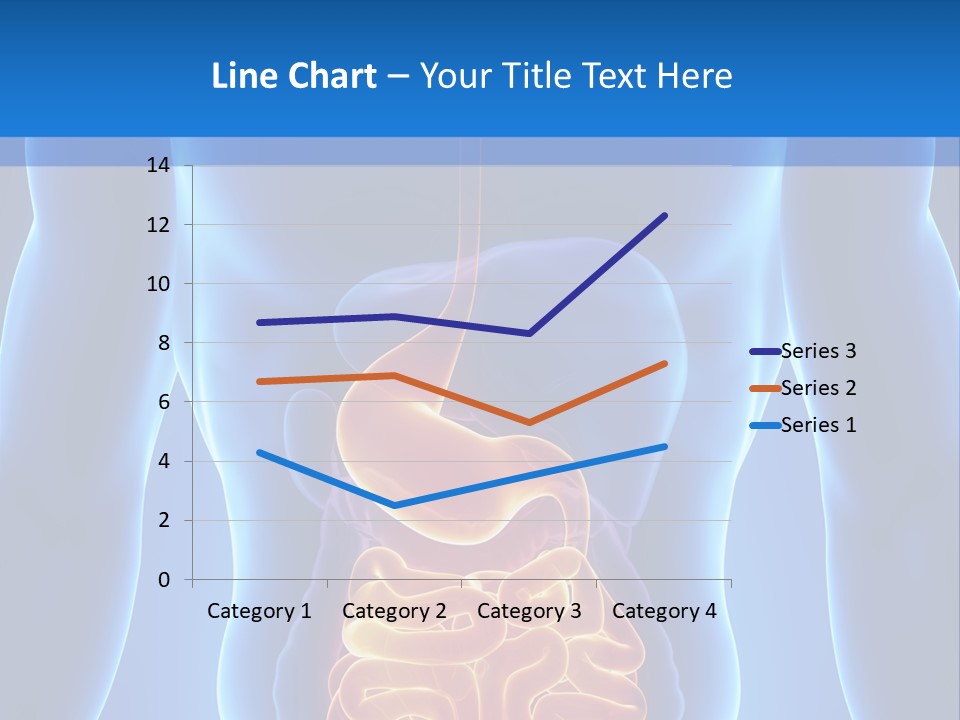 Ileocecal Valve Diagnose Abdominal PowerPoint Template