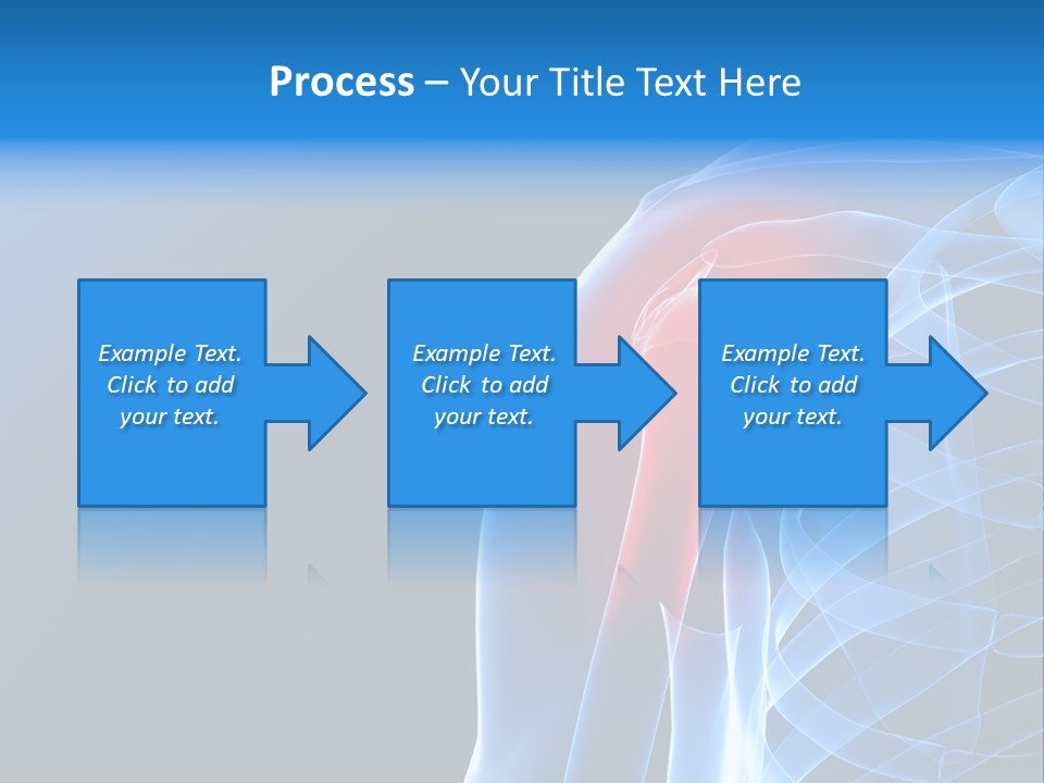 Backache Spinal Chest PowerPoint Template
