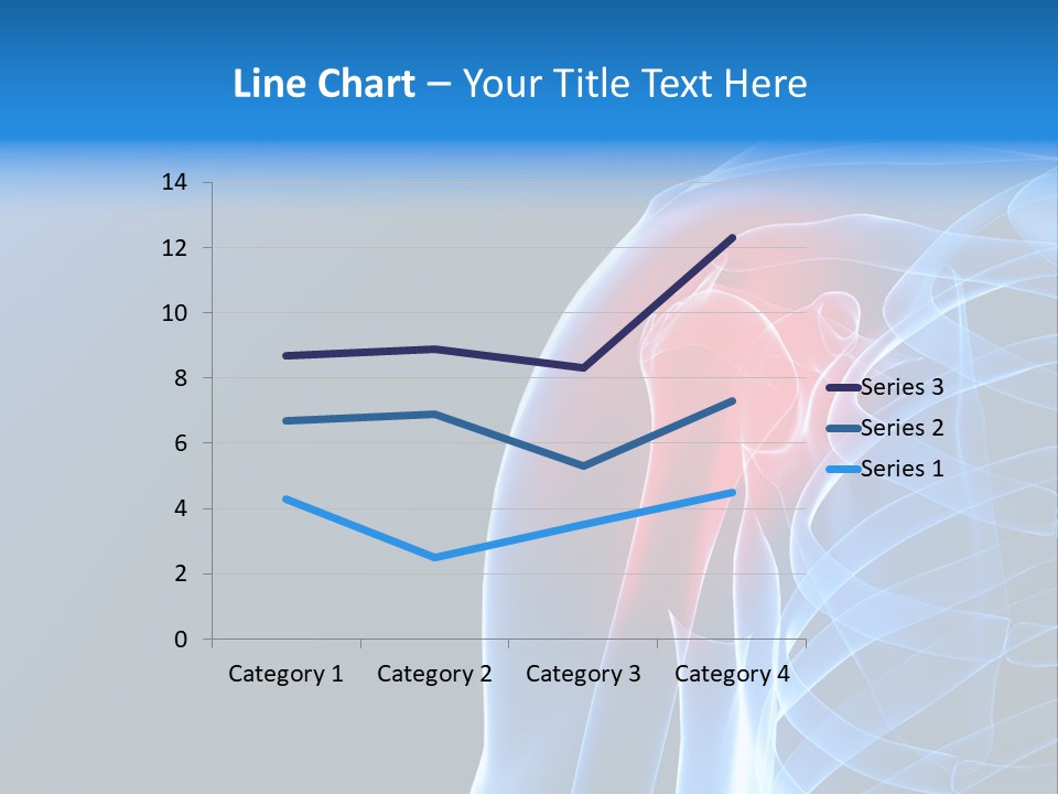 Backache Spinal Chest PowerPoint Template
