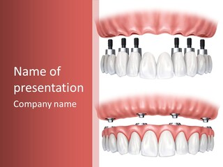 Nail Mechanical Cleaning PowerPoint Template