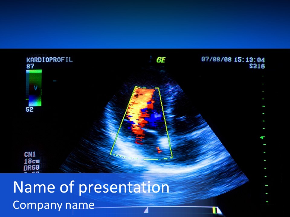 Ultrasound Health Science PowerPoint Template