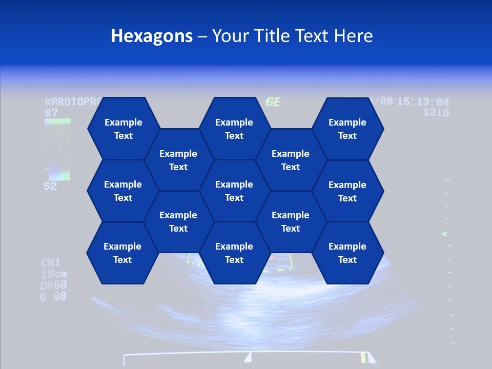 Ultrasound Health Science PowerPoint Template