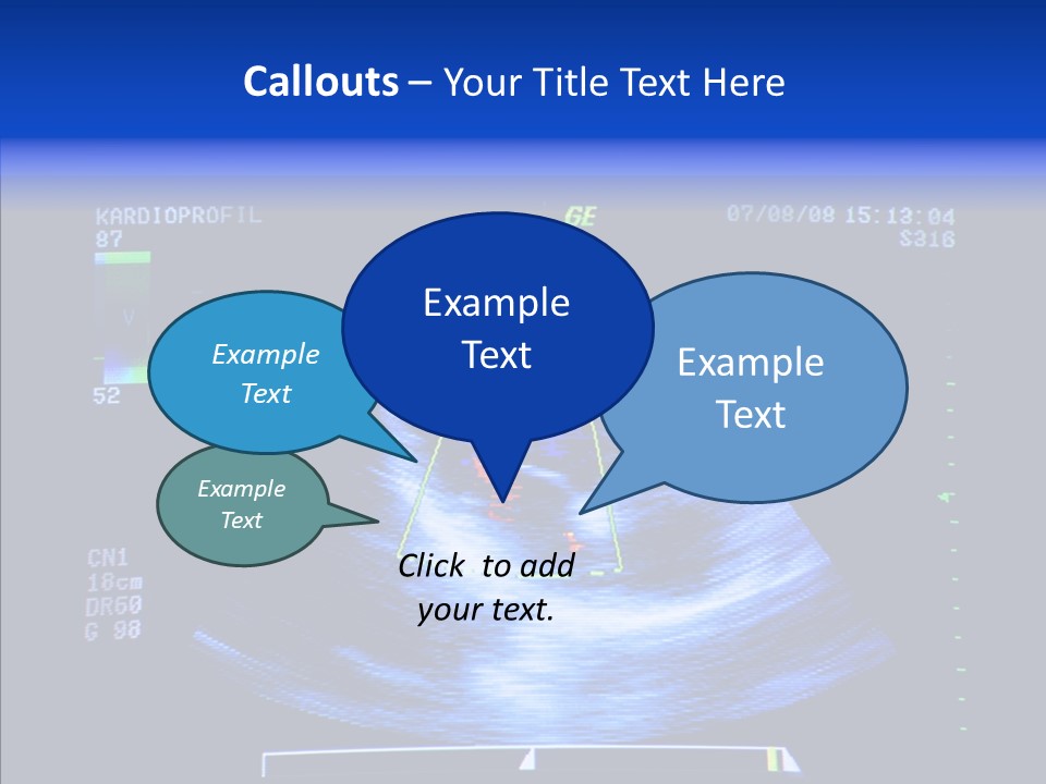 Ultrasound Health Science PowerPoint Template