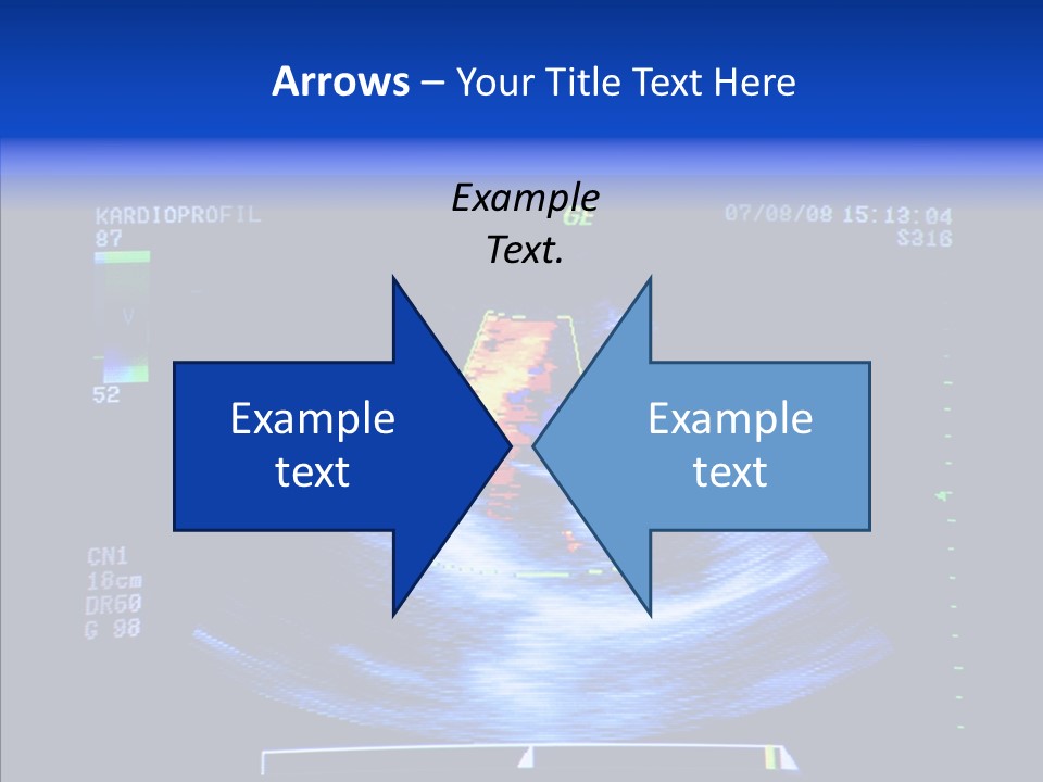 Ultrasound Health Science PowerPoint Template