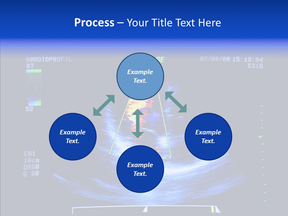 Ultrasound Health Science PowerPoint Template