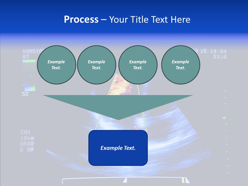 Ultrasound Health Science PowerPoint Template