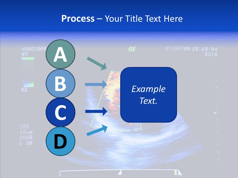 Ultrasound Health Science PowerPoint Template